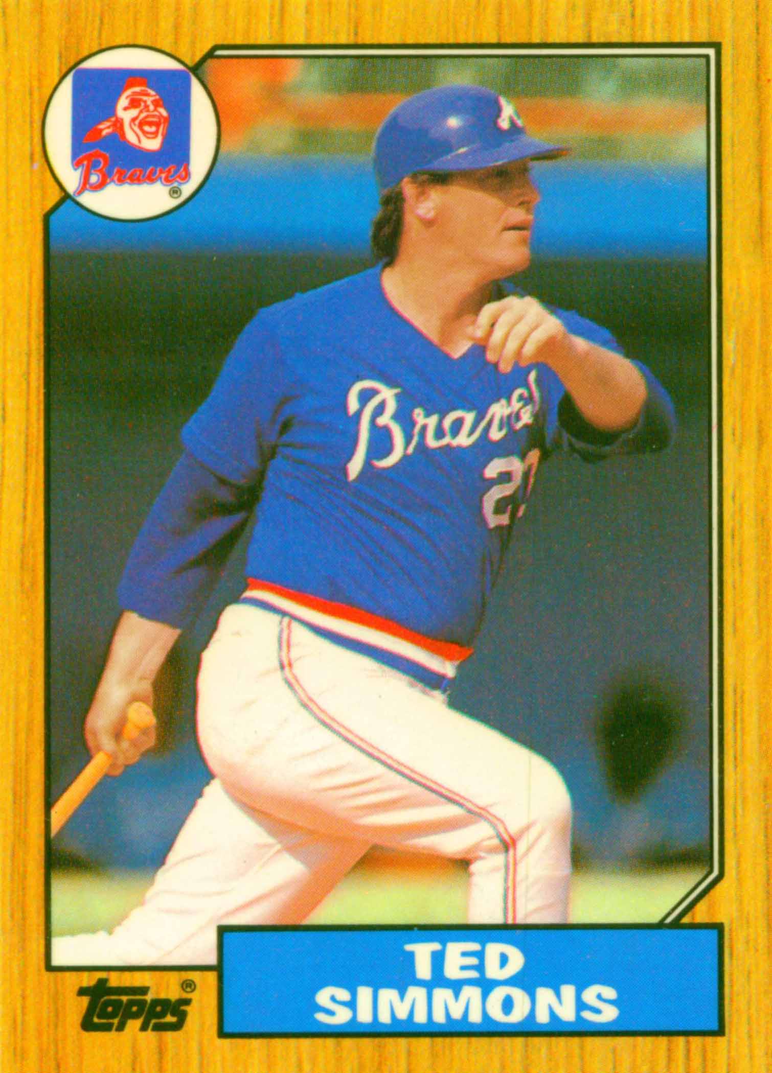 1987 Topps Tiffany